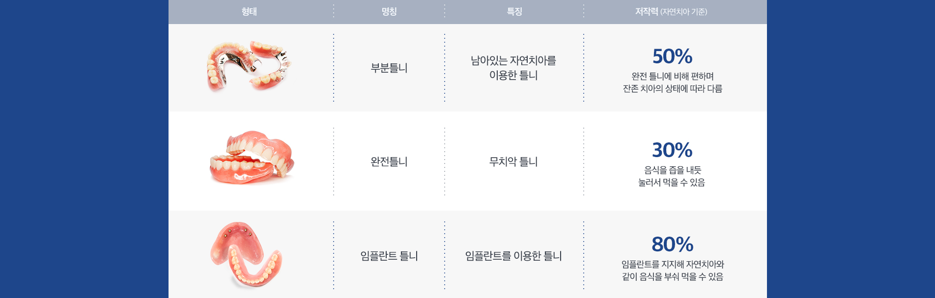 틀니 종류