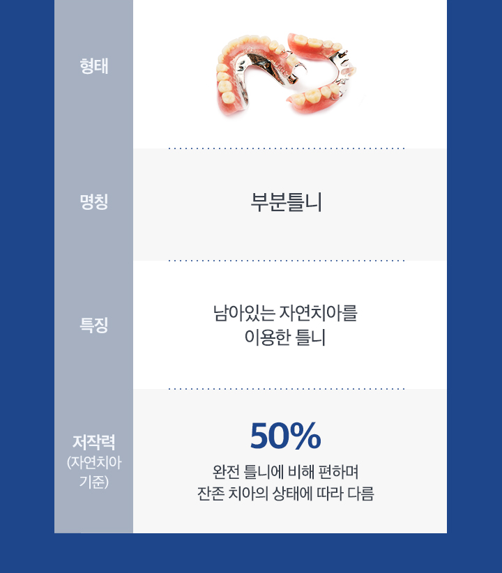 부분틀니