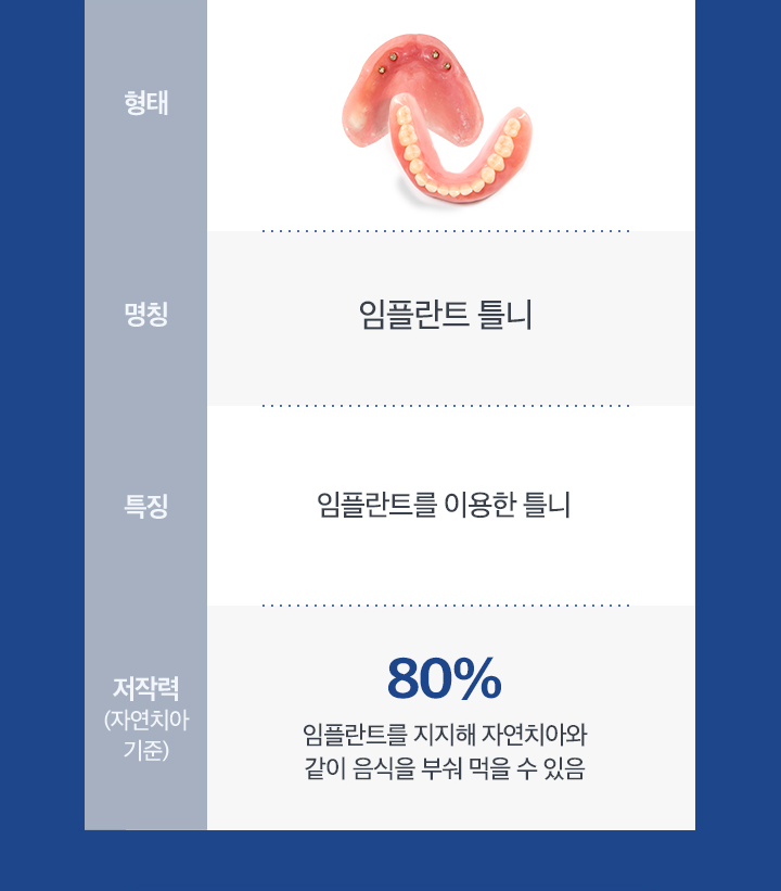 임플란트 틀니